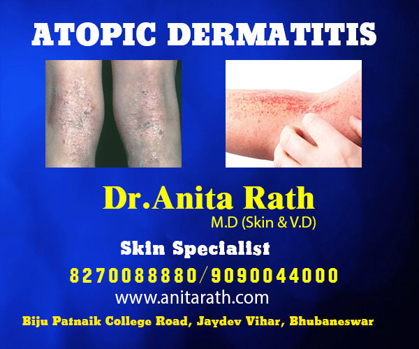best skin treatment clinic in bhubaneswar near me